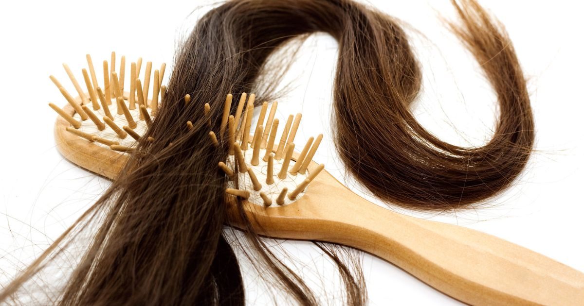 domacalekarenvypadavanievlasov