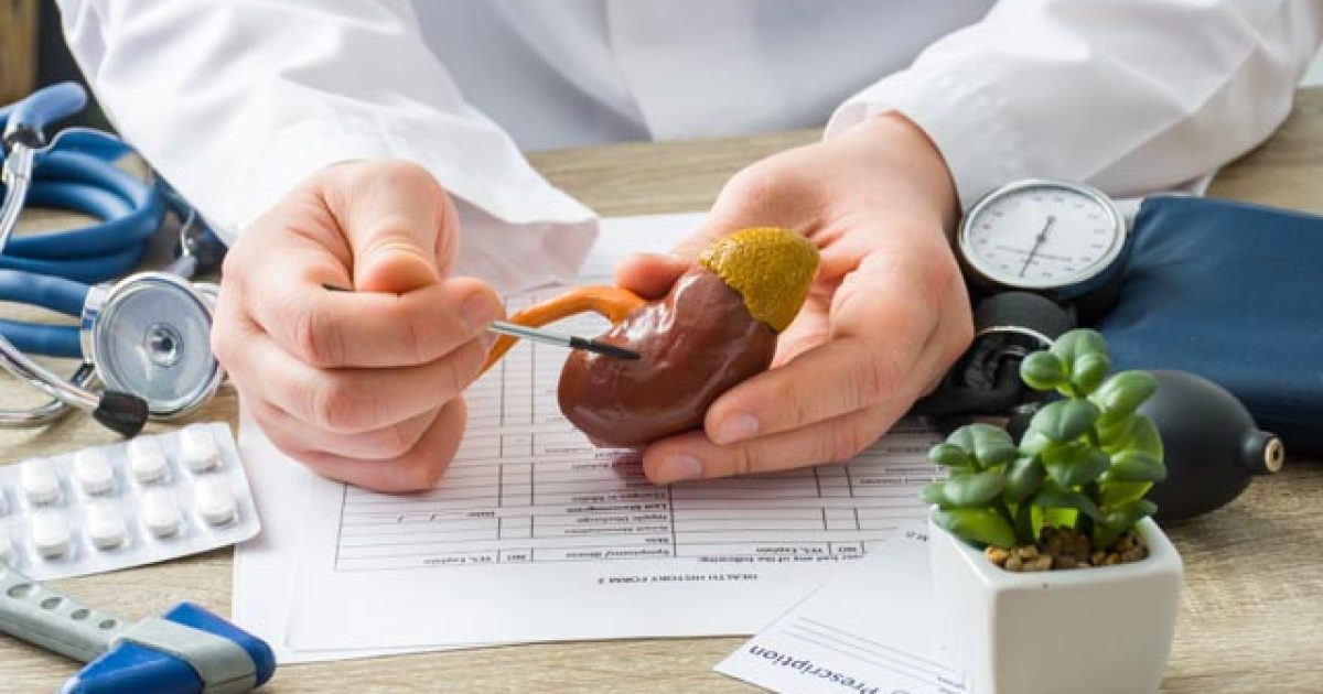 pomoczprirody-oblickove-kamene-featured